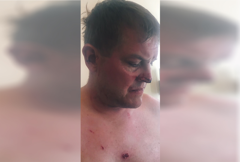 Illustration for article titled Tourist Accused of Killing Hotel Worker in Anguilla Speaks Out